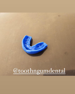 Sports Mouthguard