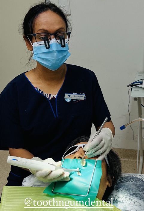 Root Canal Root Canal