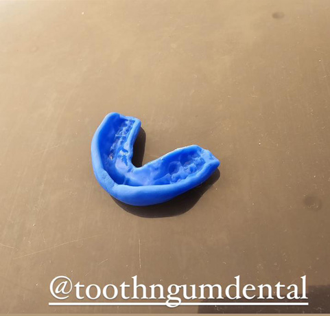 Sports Mouthguard Sports Mouthguard