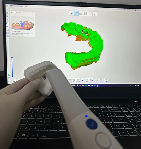 Dental Checkup Chadstone Dental Checkup Chadstone