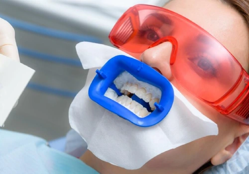 Professional teeth whitening in Huntingdale