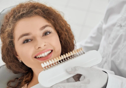 Dental shade guide