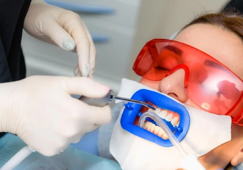 Teeth Whitening Treatment