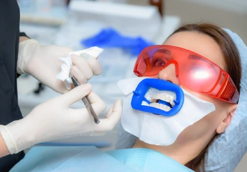 Cosmetic Teeth Whitening