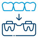 Dental Bridge
