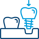Dental Implant