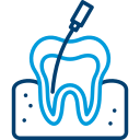 Root canal