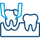 Tooth Extractions