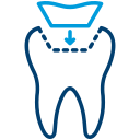 Tooth Filing